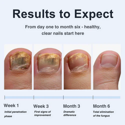 Velvia™ Antifungal Pen