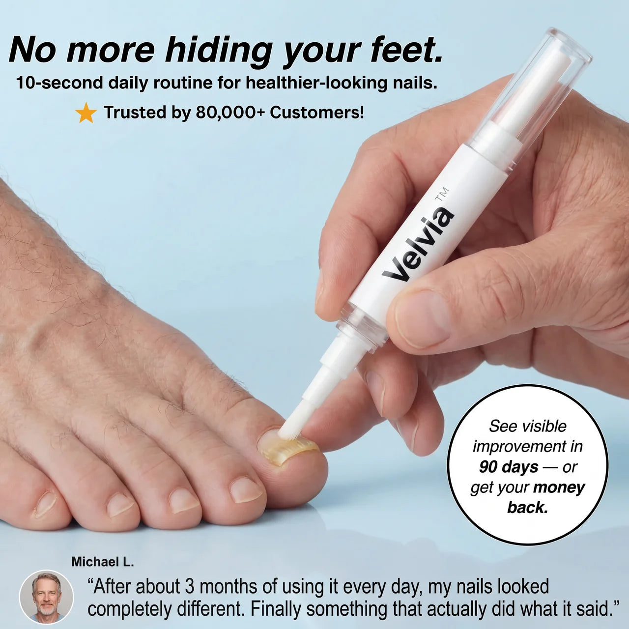 Velvia™ Antifungal Pen