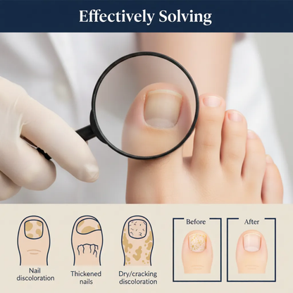 Velvia Repair Patches