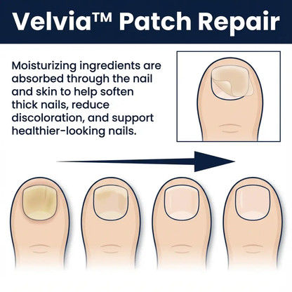 Velvia Repair Patches